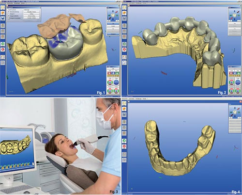 تکنولوژی Cad Cam