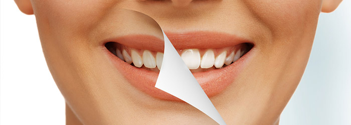 دندانپزشکی زیبایی