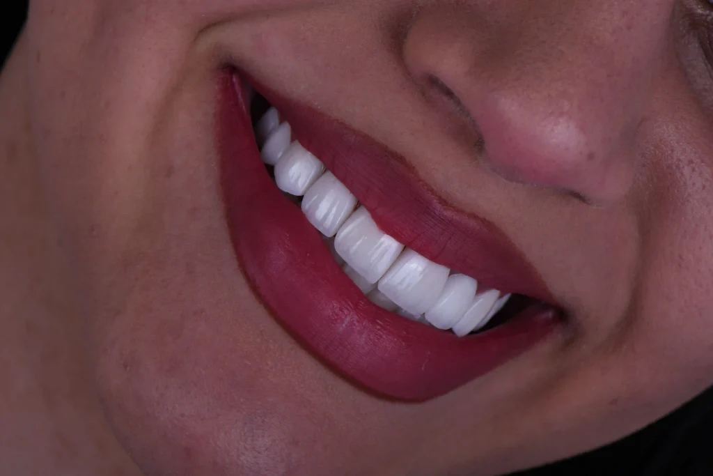بازآفرینی لبخند02