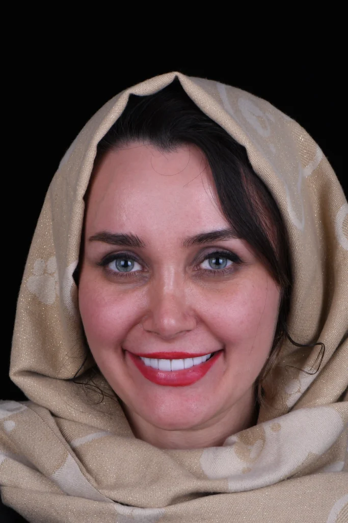 تغییر ظاهر دندان‌ها01