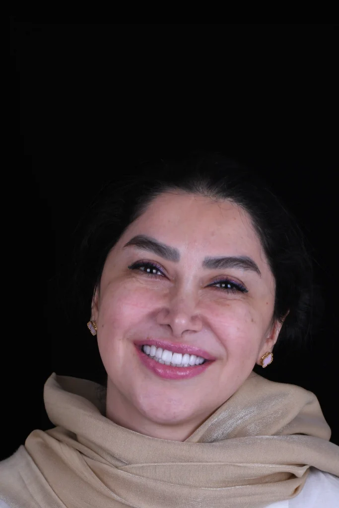 نتیجه نهایی درمان زیبایی
